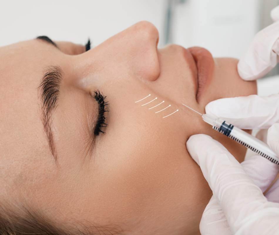 Profhilo skin bio-remodelling treatment